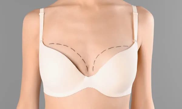 Lipofilling biustu: rewolucyjna metoda czy ryzykowny zabieg? Poznaj prawdę